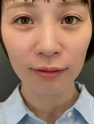 before画像