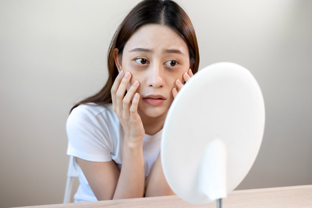 内出血を最小限に抑えるためにできること