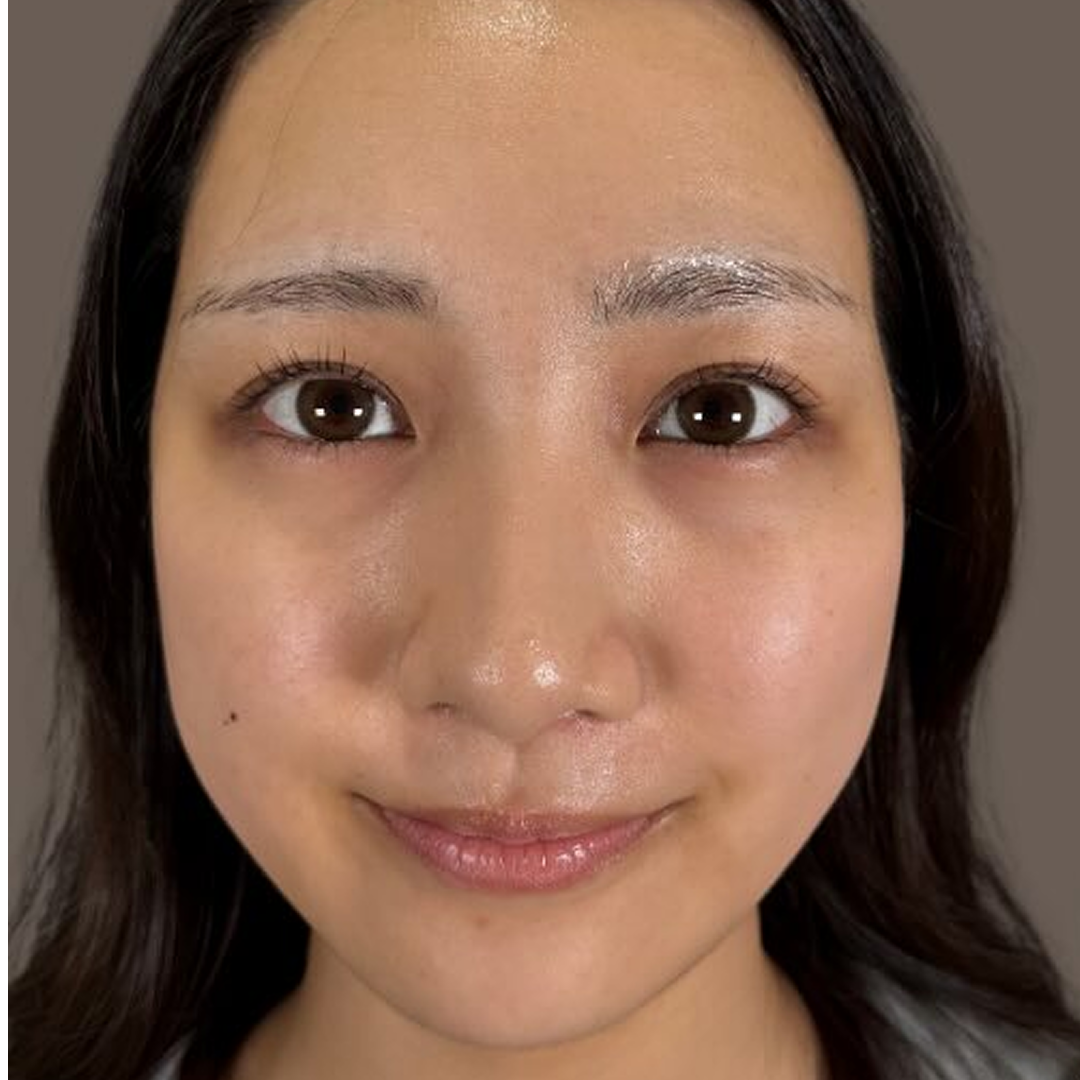 before画像