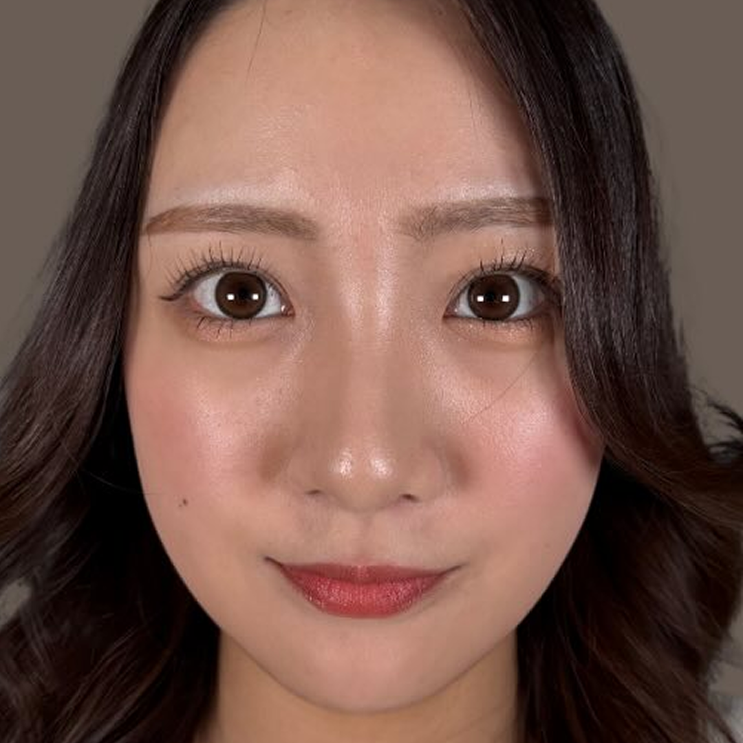 after画像