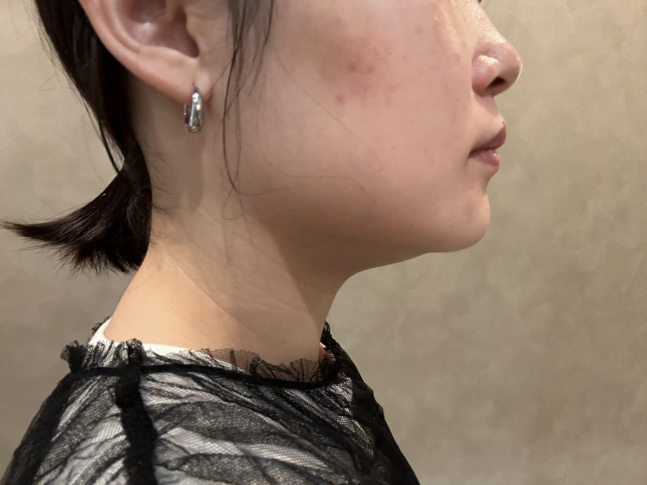 before画像
