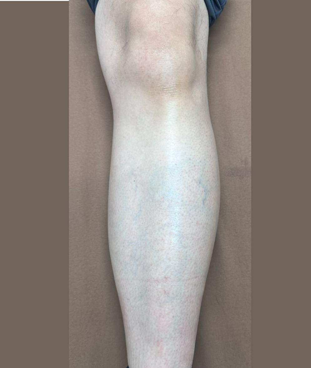 症例のafter画像