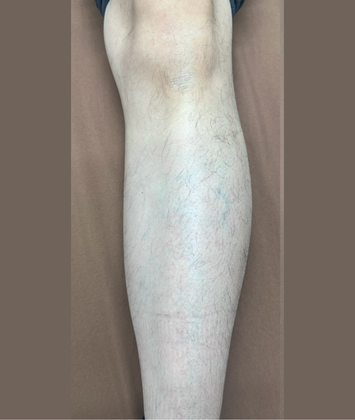 症例のbefore画像