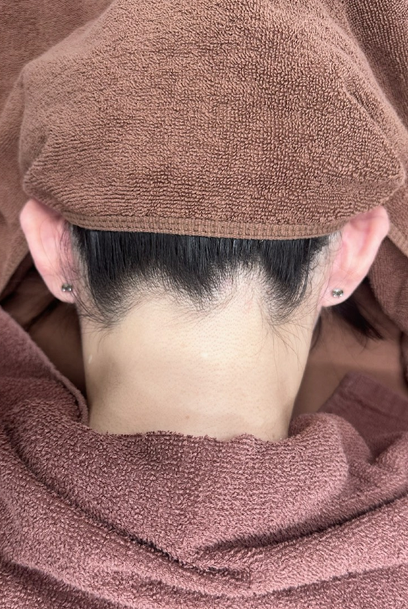 症例のafter画像