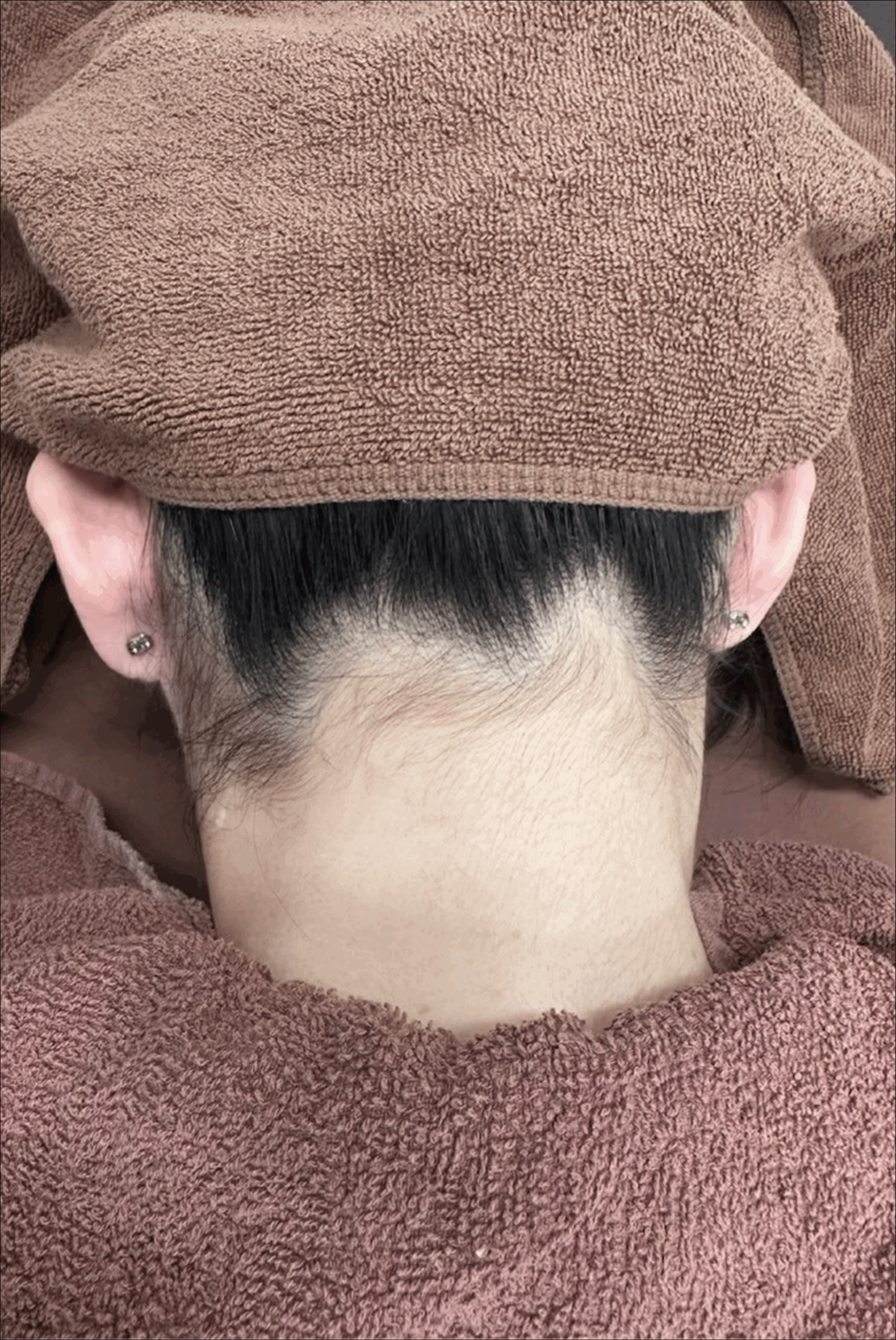 症例のbefore画像