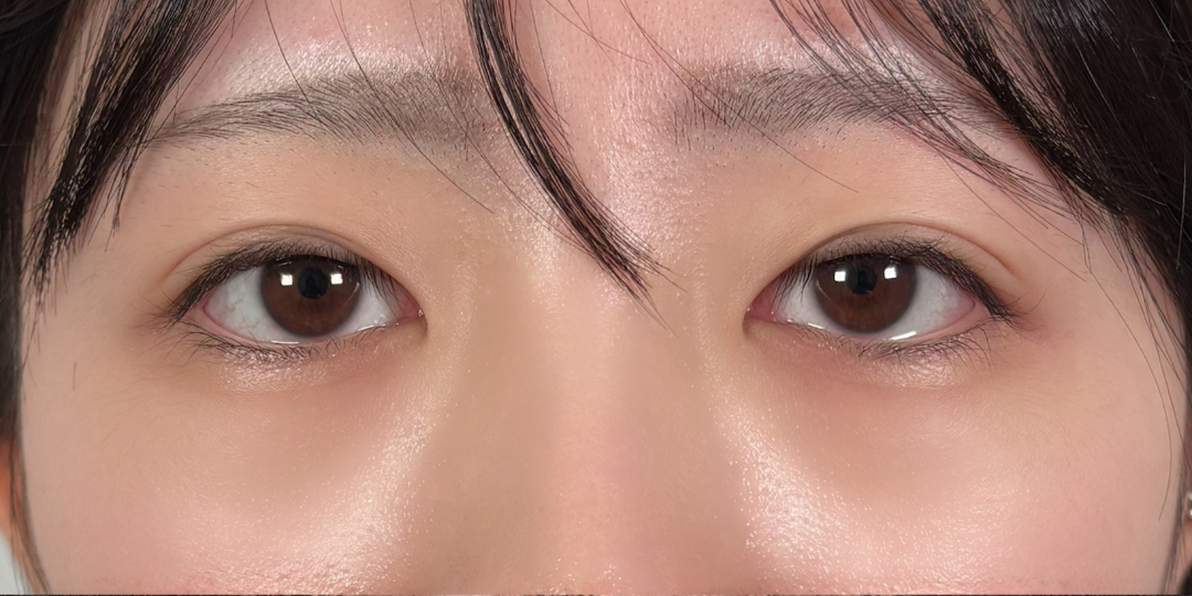 症例のbefore画像