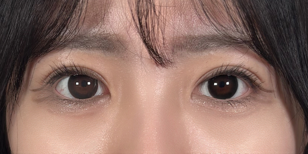 症例のafter画像