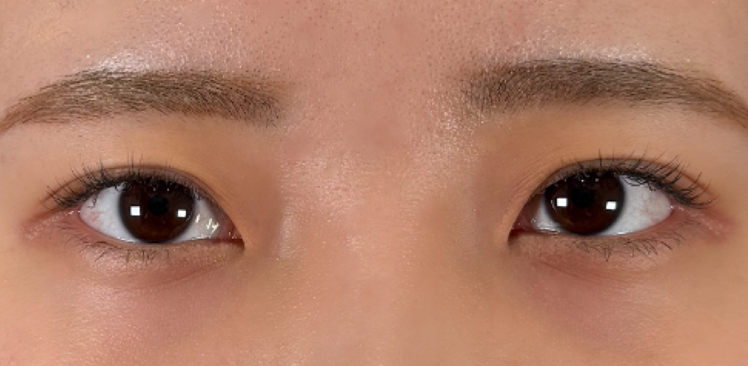 症例のafter画像