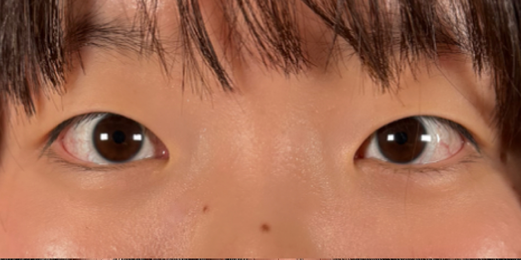 症例のbefore画像