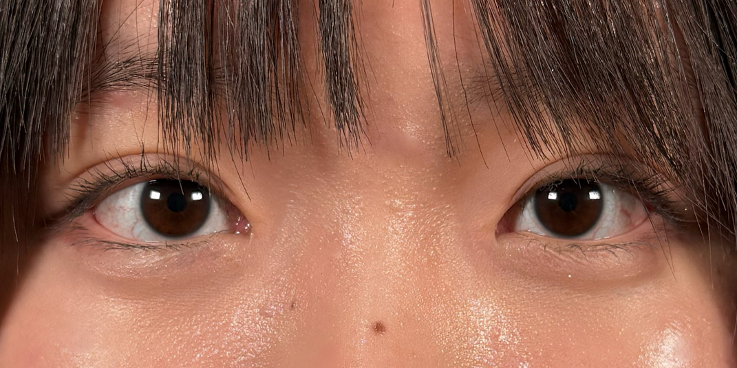 症例のafter画像