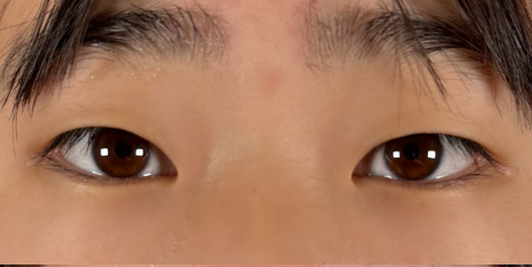 症例のbefore画像