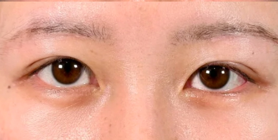 症例のafter画像