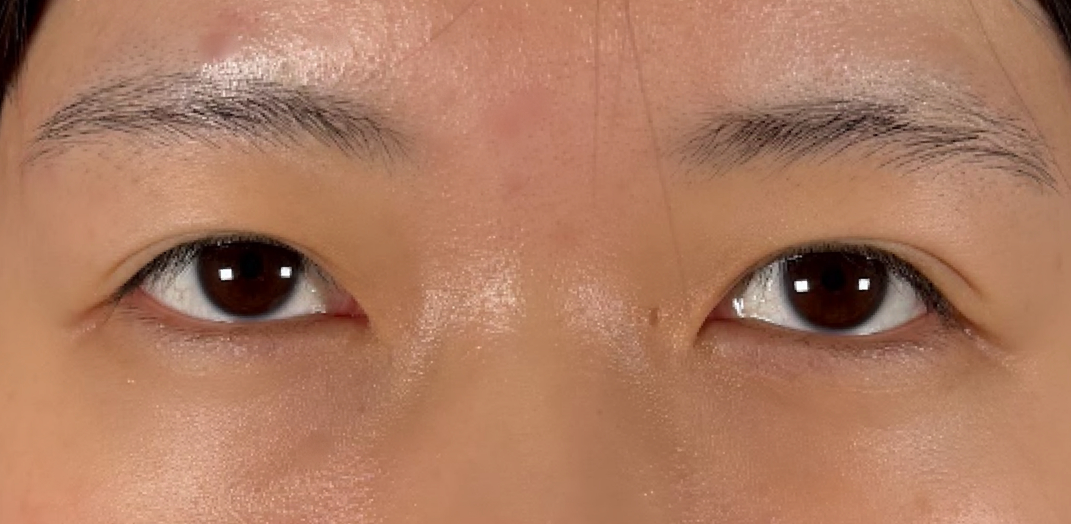 症例のbefore画像