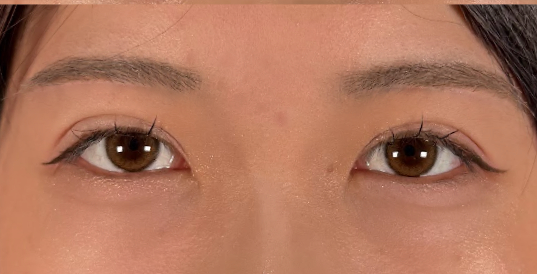 症例のafter画像