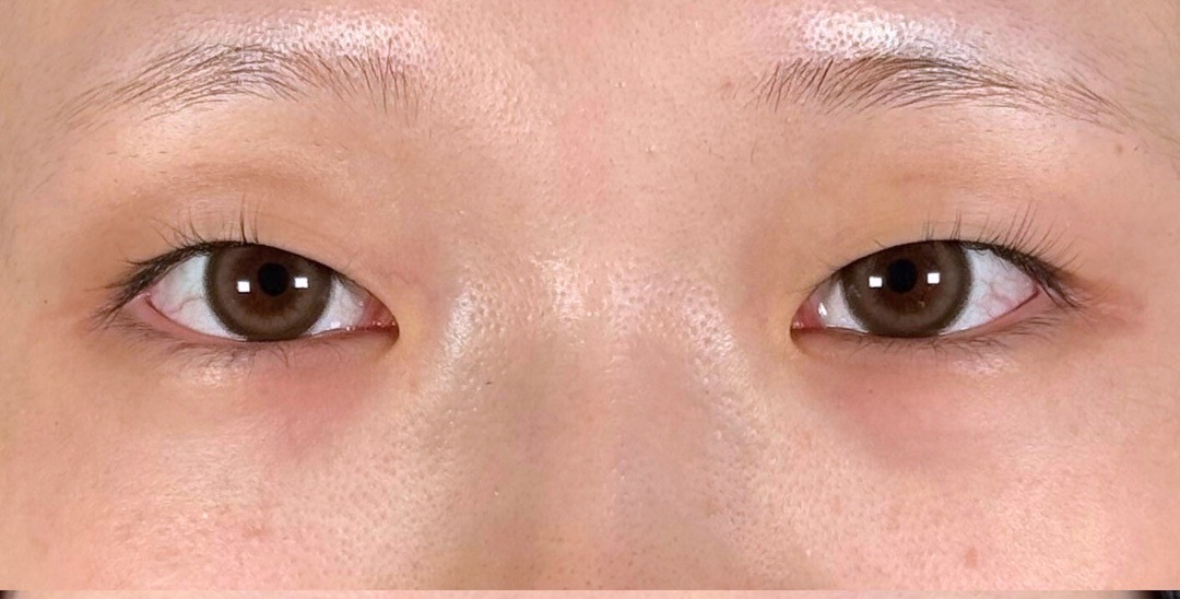 症例のbefore画像