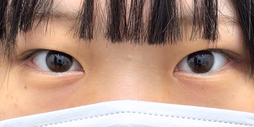 症例のbefore画像