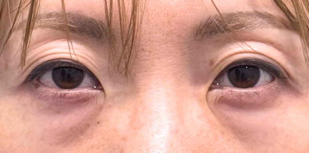 症例のbefore画像