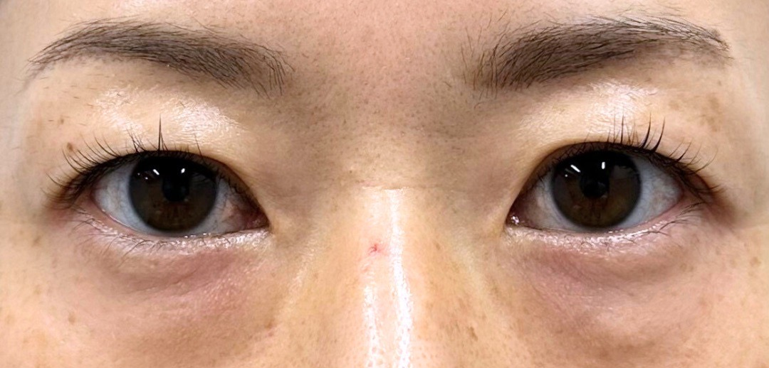 症例のbefore画像