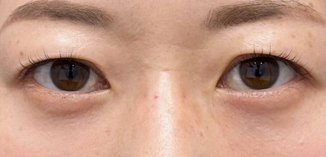 症例のafter画像