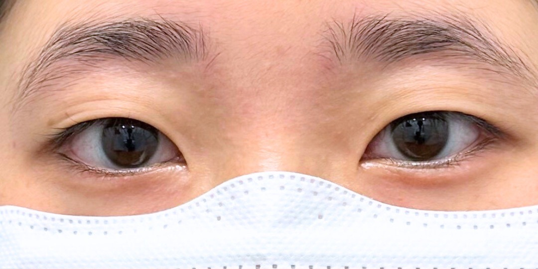 症例のbefore画像