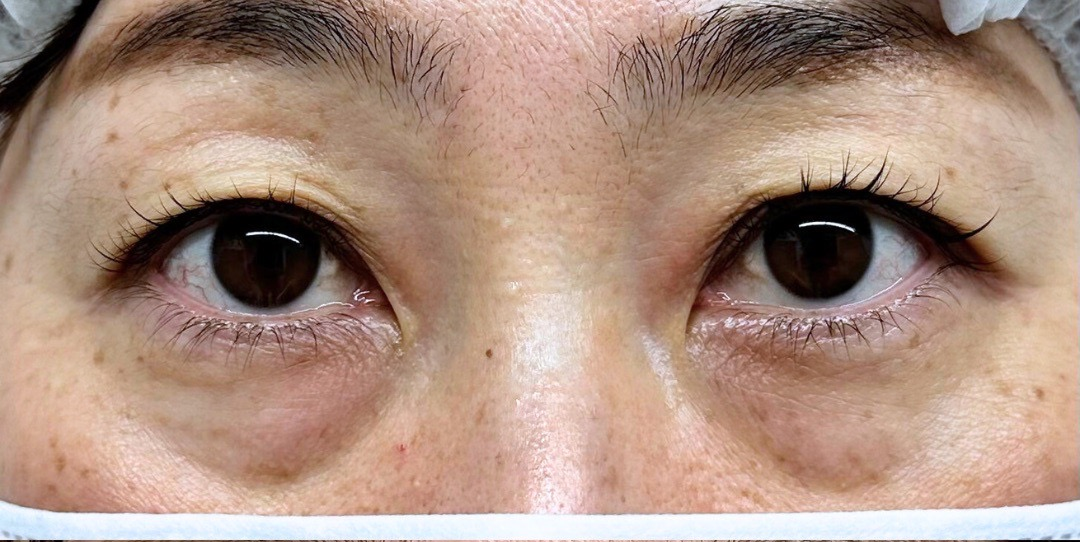 症例のbefore画像