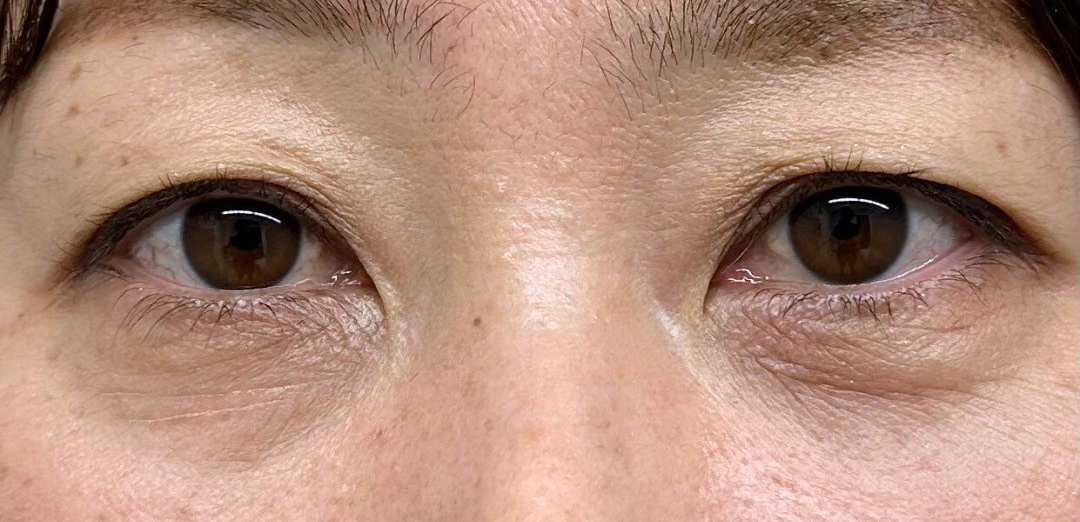 症例のafter画像