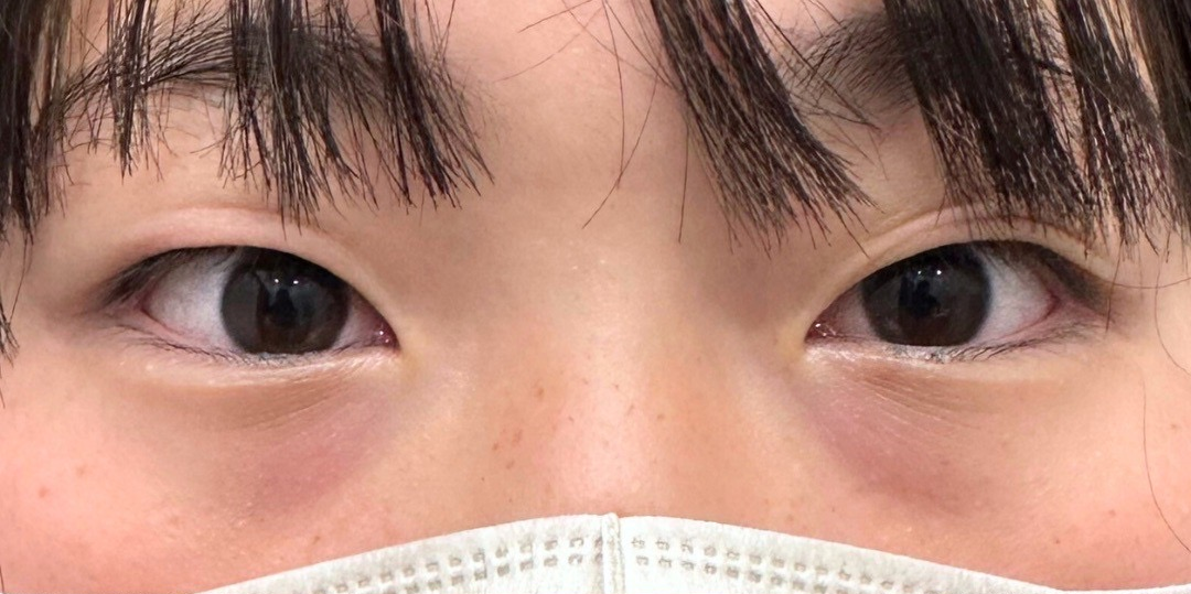 症例のbefore画像