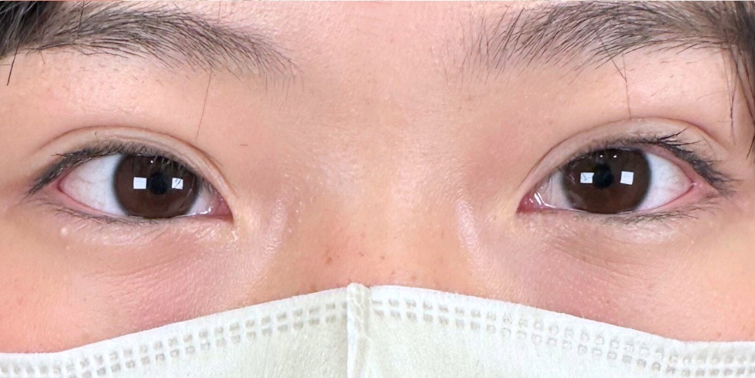 症例のafter画像