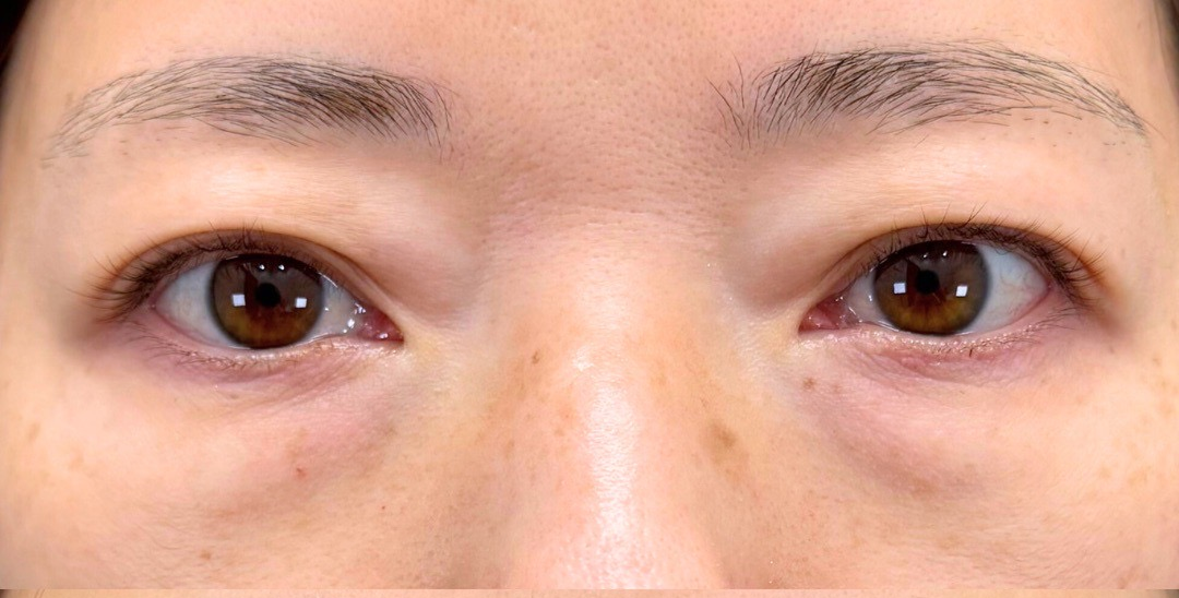 症例のbefore画像