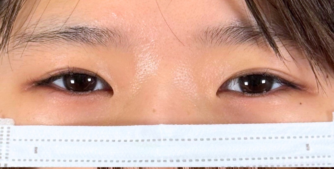 症例のbefore画像