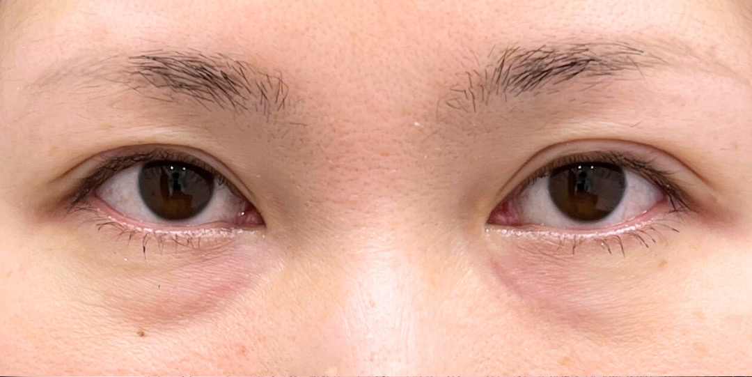 症例のbefore画像