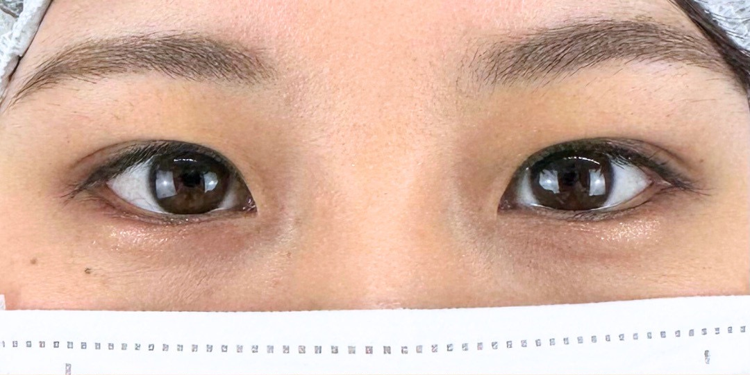 症例のbefore画像