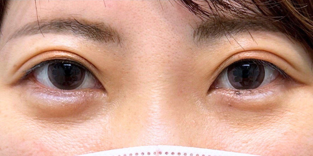 症例のafter画像