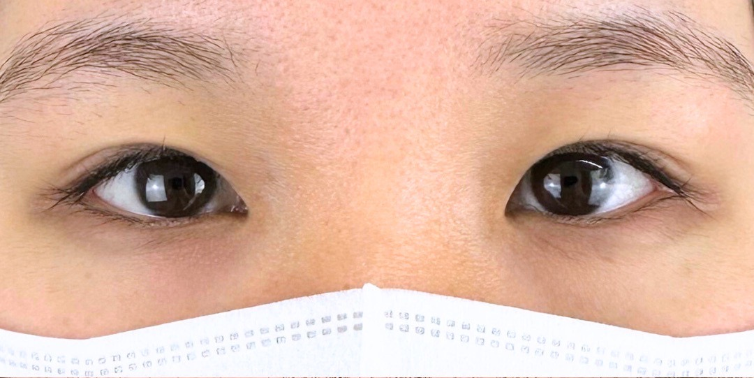 症例のbefore画像