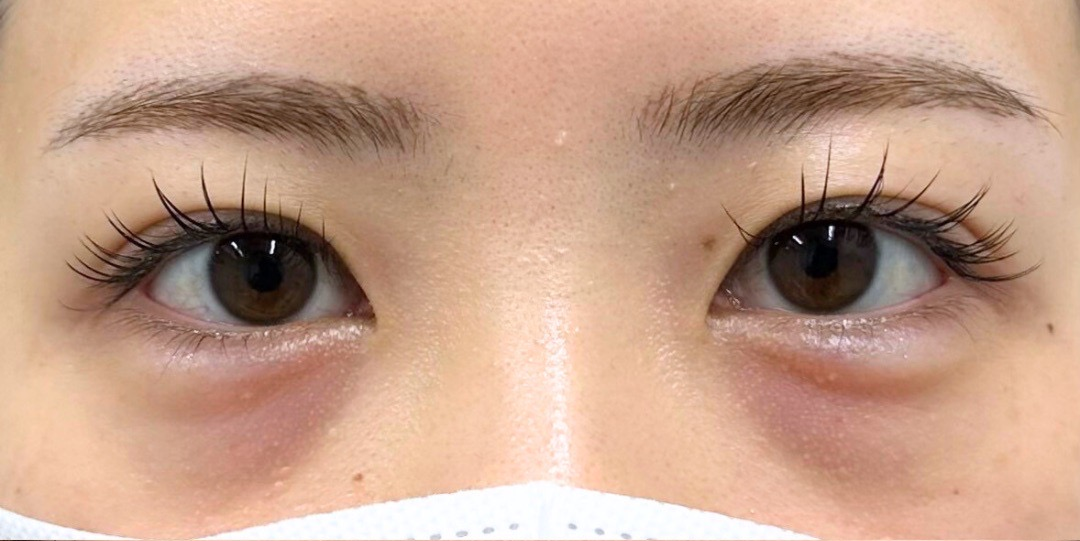 症例のbefore画像