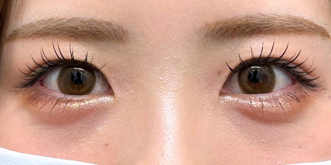 症例のafter画像