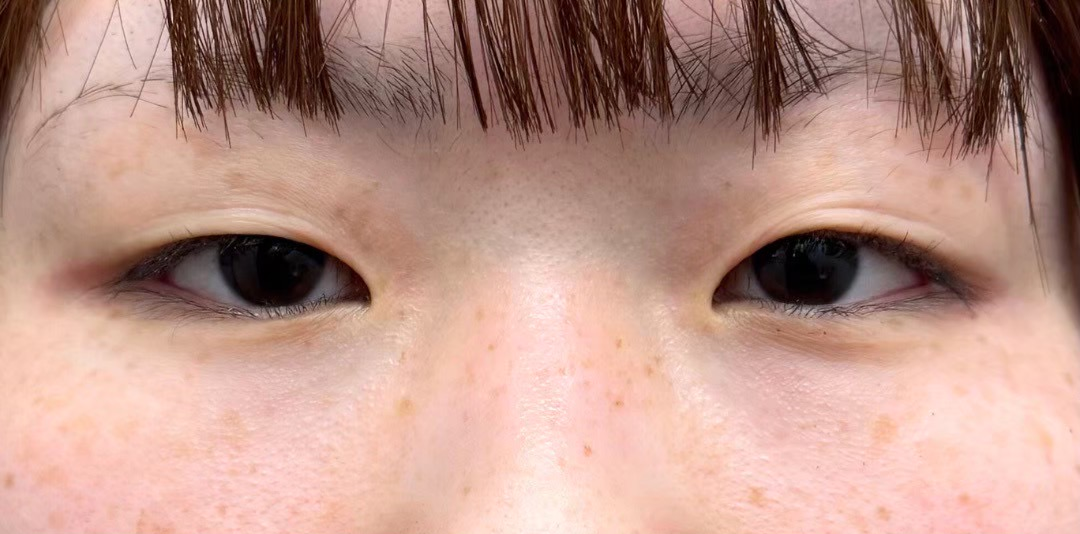 症例のbefore画像