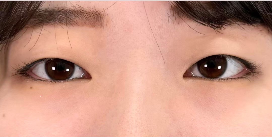 症例のbefore画像