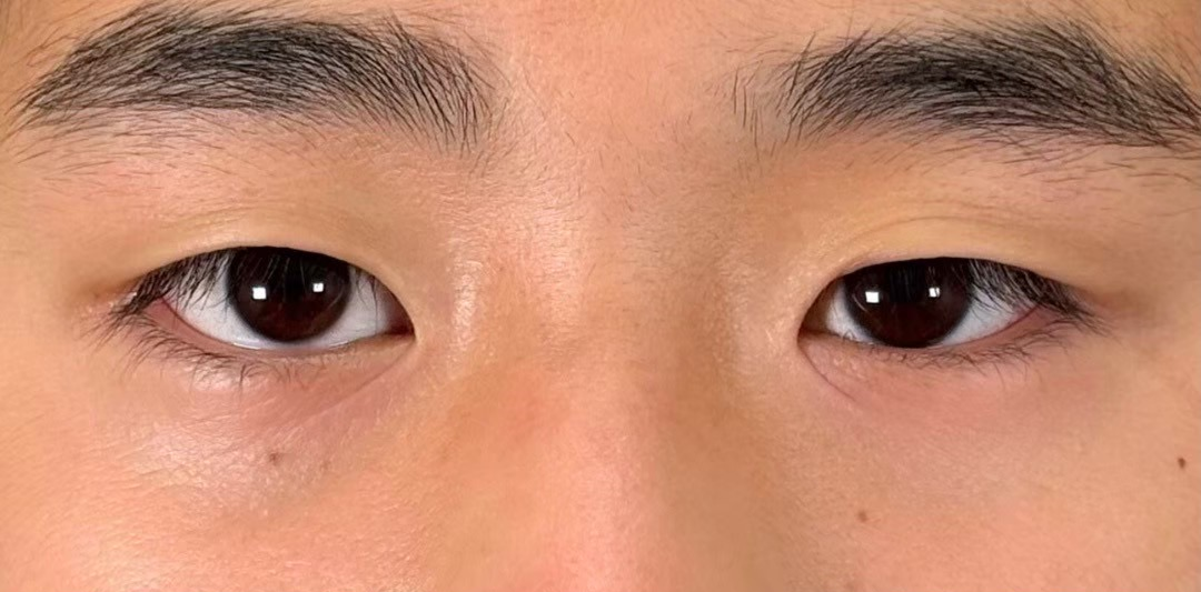 症例のbefore画像