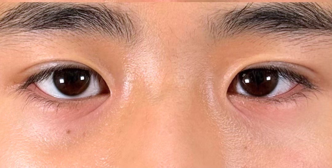 症例のafter画像