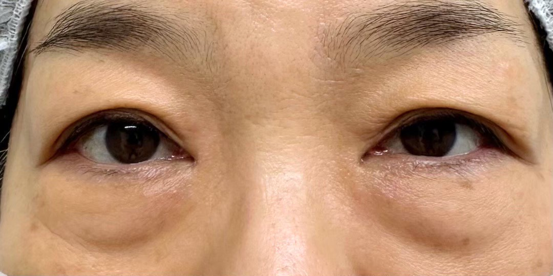 症例のbefore画像