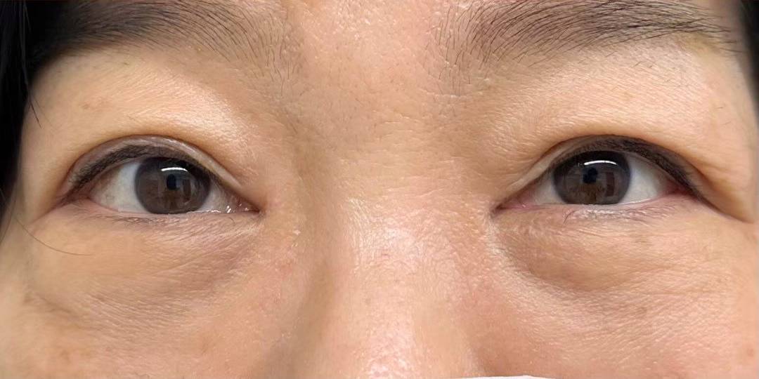 症例のafter画像