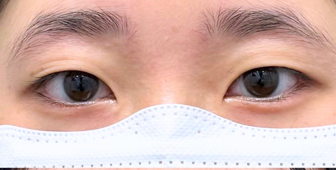 症例のbefore画像