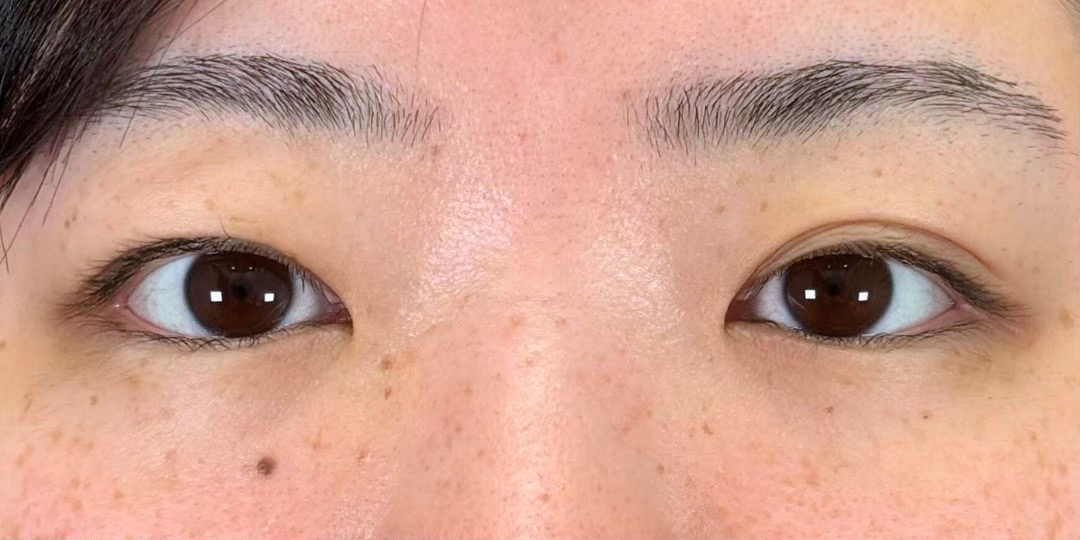 症例のbefore画像