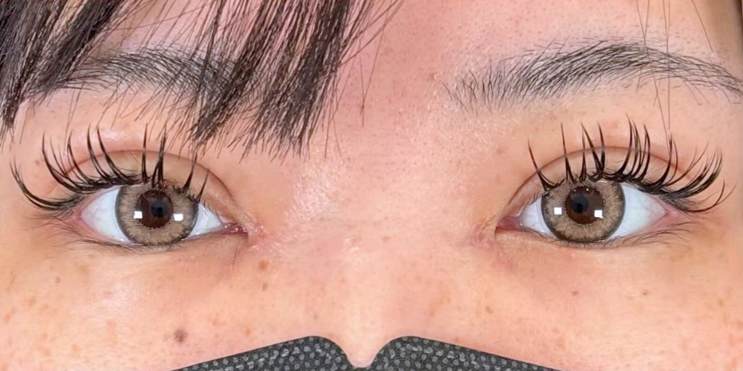 症例のafter画像