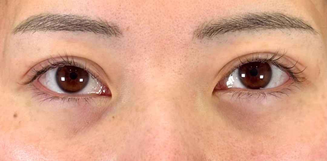 症例のbefore画像