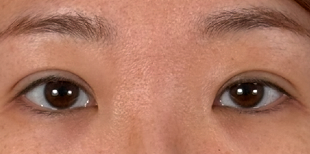 症例のafter画像