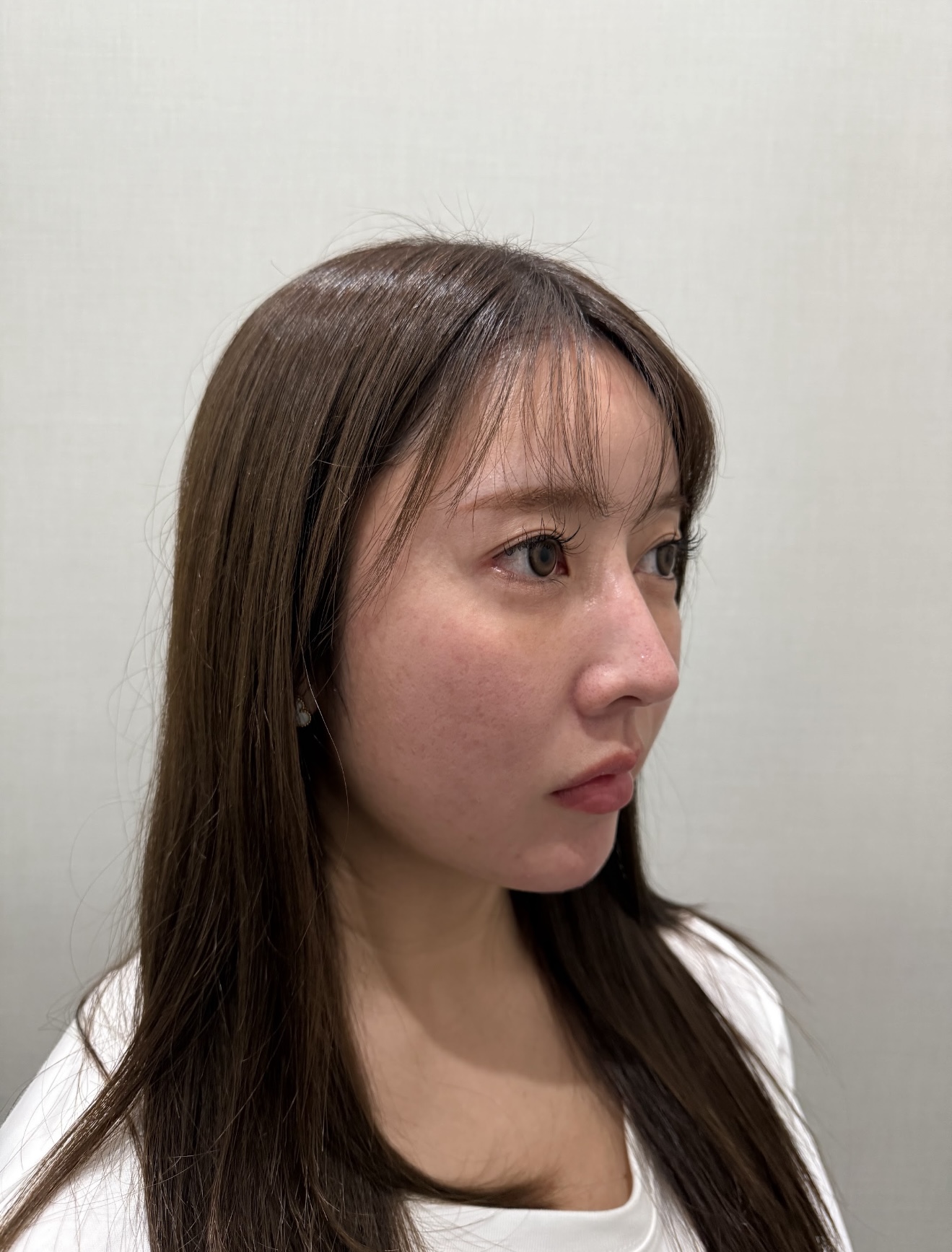 症例のbefore画像