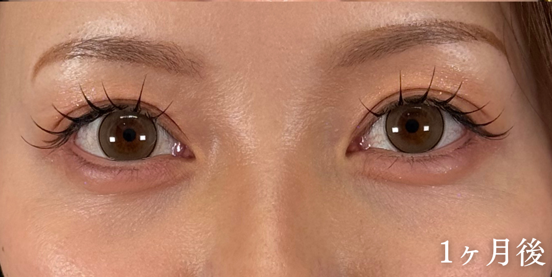 症例のafter画像