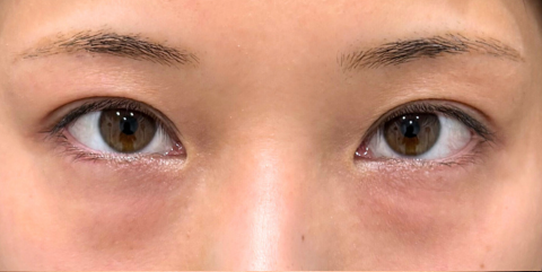 症例のbefore画像